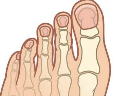 Perubahan Struktur Tulang pada Kaki: Mengapa Bentuk Jempol Berubah?